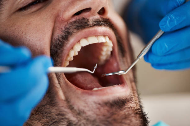 Best Emergency Tooth Extraction in Franklin Rk, PA
